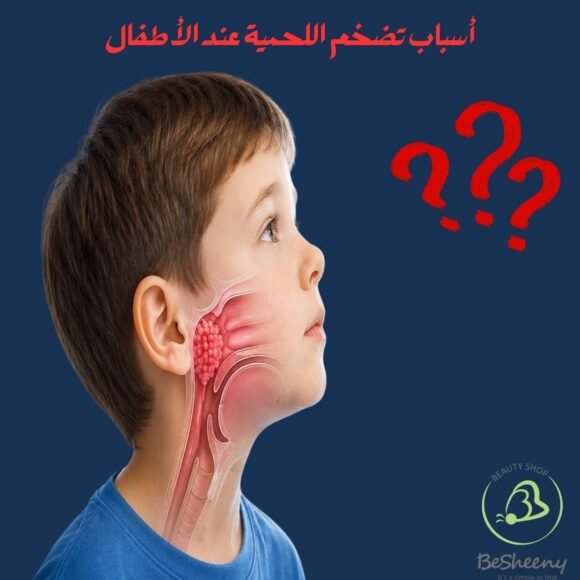 أسباب تضخم اللحمية عند الأطفال