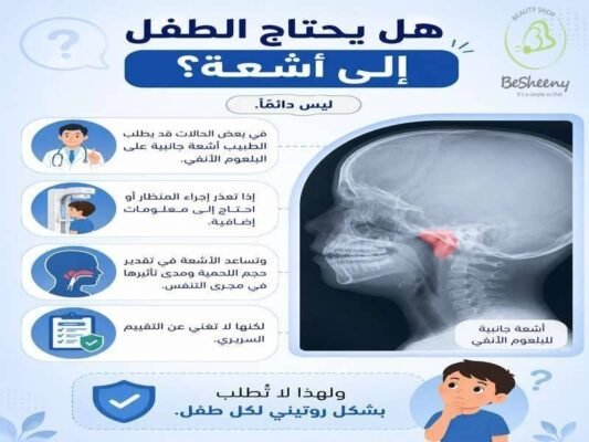 هل يحتاج الطفل إلي أشعة
