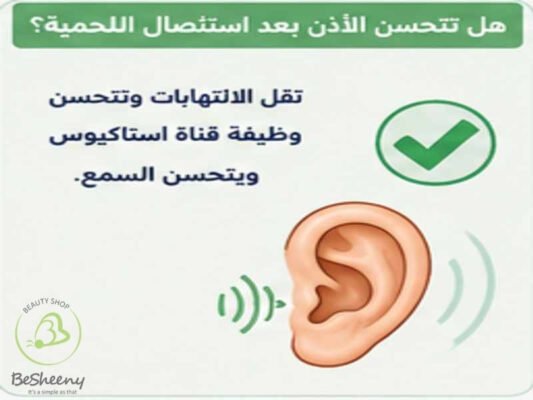 هل تتحسن الاذن بعد استئصال اللحمية