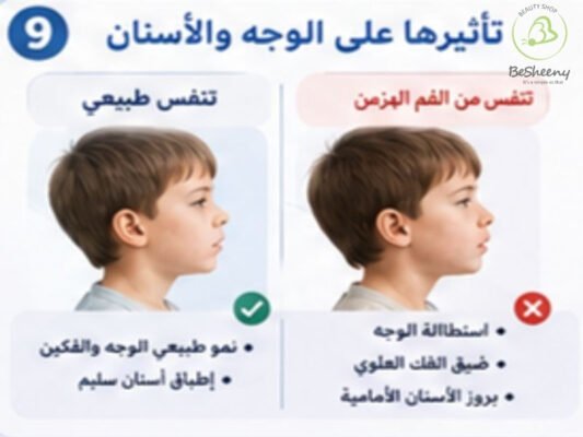 تاثيرها علي الوجه و الاسنان