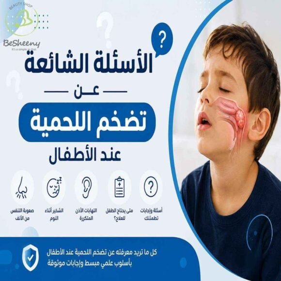 الأسئلة الشائعة عن تضخم اللحمية عند الأطفال