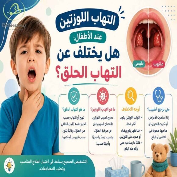 التهاب اللوزتين هل يختلف عن التهاب الحلق