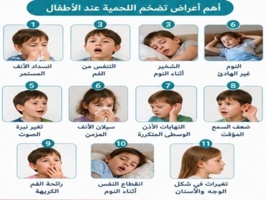 اهم الاعراض