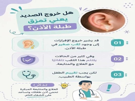 خروج الصديد