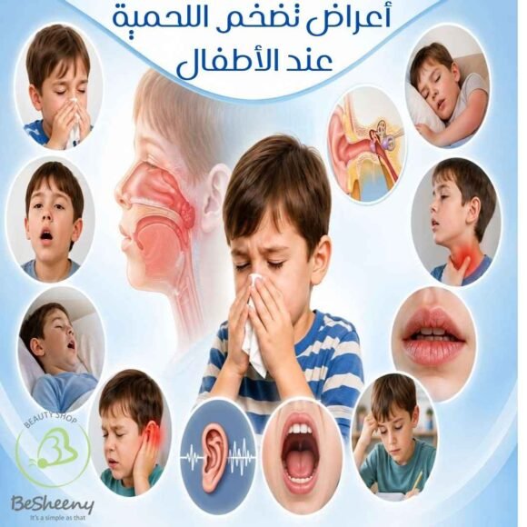 أعراض تضخم اللحمية عند الأطفال