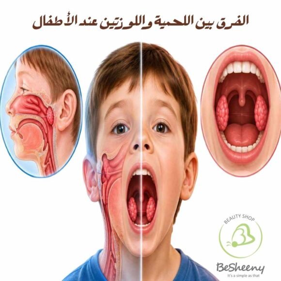 الفرق بين اللحمية واللوزتين عند الأطفال
