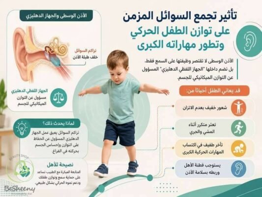 تأثير تجمع السوائل