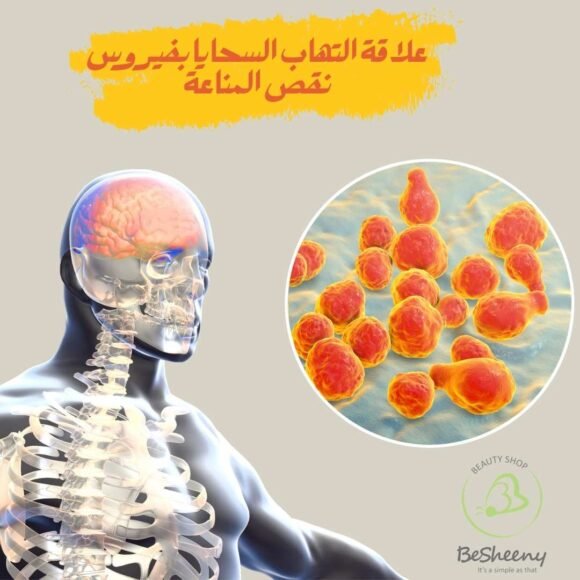 علاقة التهاب السحايا بفيروس نقص المناعة