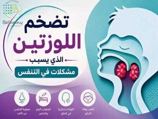 تضخم اللوزتين 