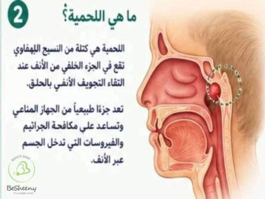 ما هي اللحمية 
