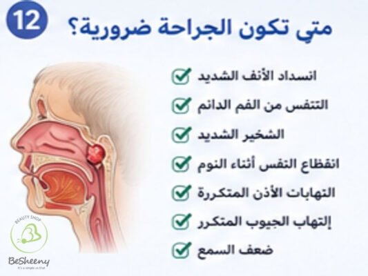 متي تكون الجراحة ضرورية