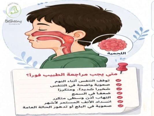 متي نذهب للطبيب