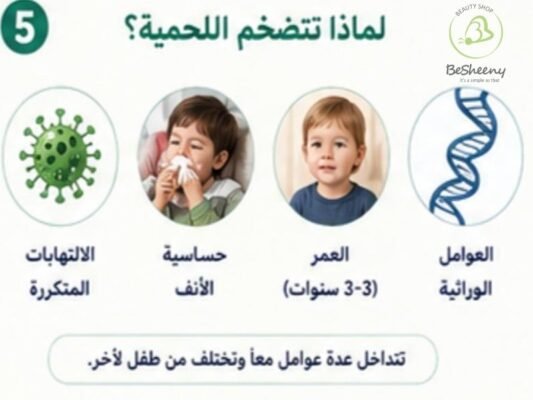 لماذا تتضخم اللحمية