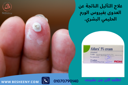 كريم ألدارا لمرضى تقرن الجلد السفعي aldara cream