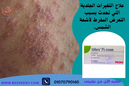 الدارا كريم للبثور الجلدية aldara sachets
