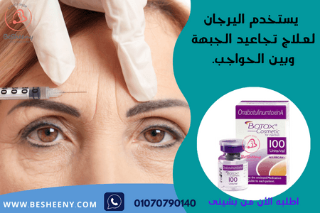 بوتكس أليرجان لعلاج التجاعيد بين الحواجب