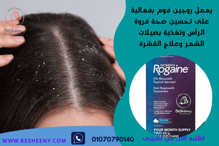 روجين فوم للمساعدة على القضاء على قشرة الشعر