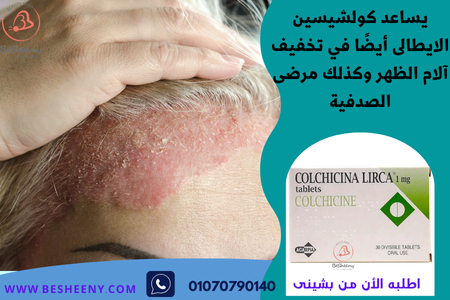 كولشيسين الايطالى لمرضى الصدفية - COLCHICINA