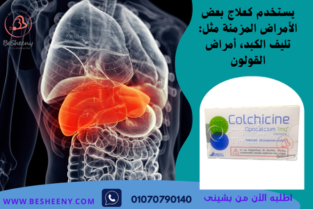 كولشيسين الفرنسى المستورد - Colchicine
