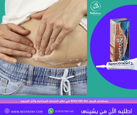 سبكترا لدعم صحة الجلد للندبات والجروح والحروق وحفر الوجه