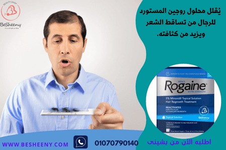 روجين للمساعدة في حل مشكلة الصلع