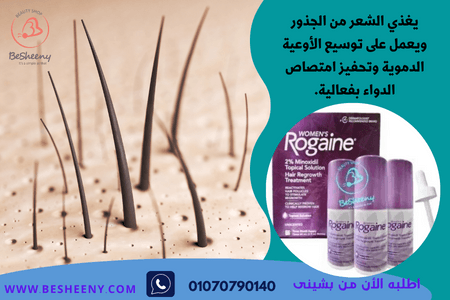 محلول روجين النسائى الأمريكى لملأ فراغات الشعر