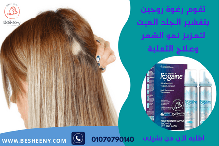 رغوة روجين الأمريكية للمساعدة في الحد من الثعلبة