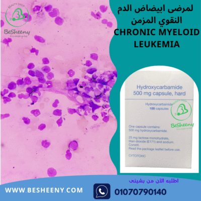 hydroxyurea 500 الانجليزى لمرضى اختلال الدم