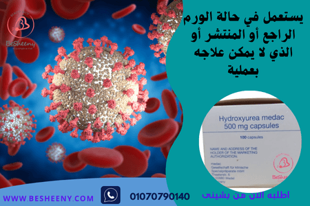 هيدروكسى يوريا الألمانى لمرضى الأورام المنتشرة