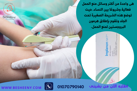 يدوم مفعول امبلانون لمدة 3 سنوات