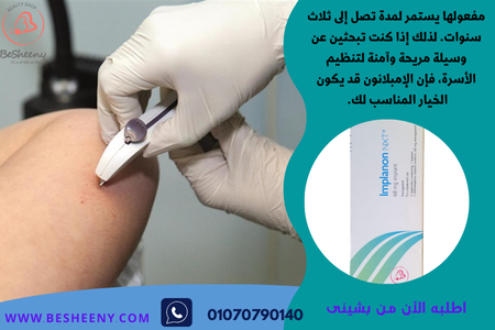 امبلانون شريحة هرمونية لمنع الحمل تحت الجلد