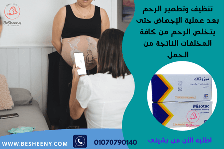 ميزوتاك أقراص للولادة