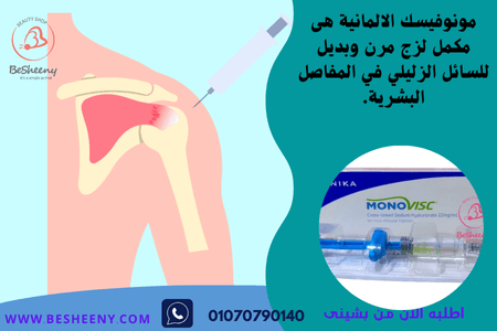 مونوفيسك حقن الزيت للمفاصل - monovisc