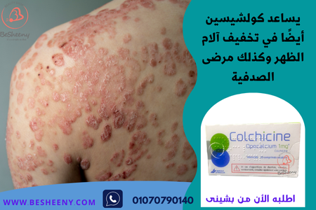 يتوفر عبر المتجر فقط بوصفة معتمدة