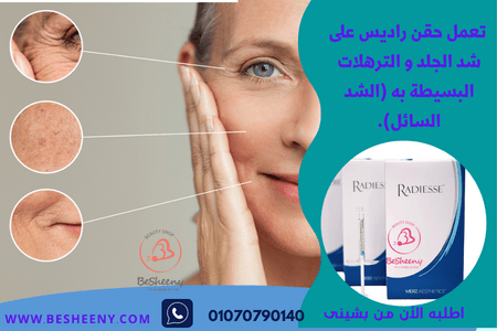  Radiesse للحفاظ على نضارة البشرة