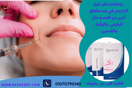 Radiesse للمساعدة على تفتيح مناطق الوجه والبكينى والركبة