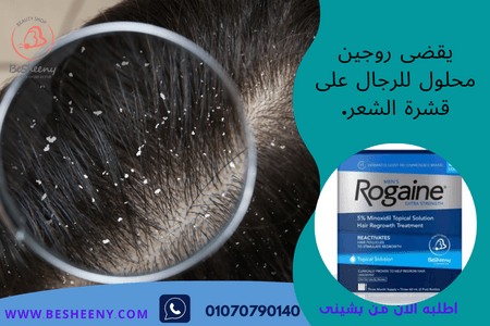 محلول روجين للرجال للمساعدة في التخلص من القشرة