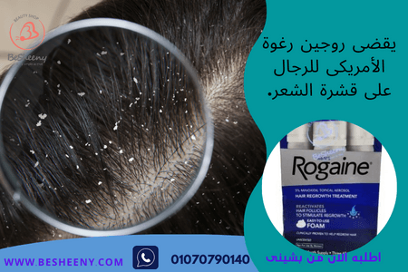 روجين فوم الأمريكى للرجال لللمساعدة على القضاء على القشرة