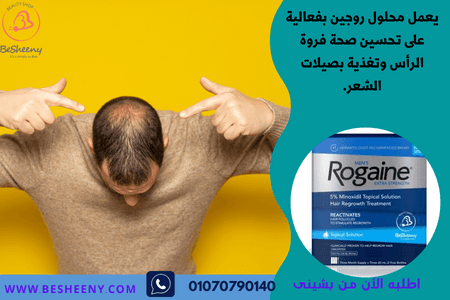 روجين يساعد بصيلات الشعر فى النمو