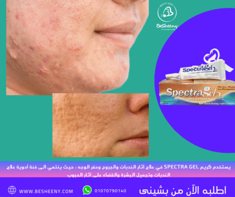 سبكترا لدعم صحة الجلد يدعم تليين ملمس الندبات القاسية