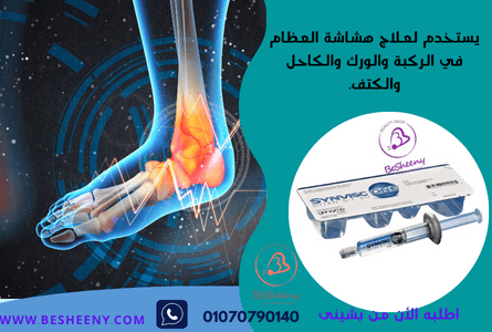 سينفيسك وان لمرونة المفصل