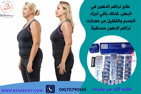 زوريل بلس الأنبوب الاصدار الاقوى