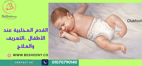 القدم المخلبية عند الأطفال .. التعريف والعلاج