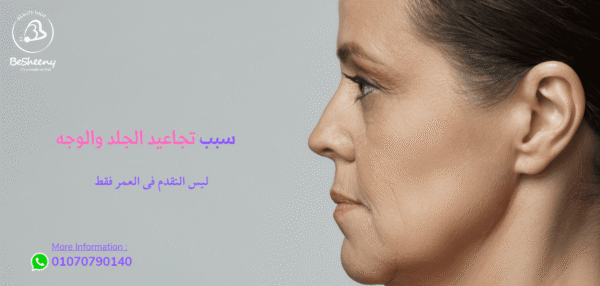 تجاعيد الجلد والوجه