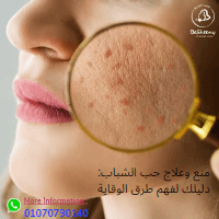منع وعلاج حب الشباب. دليلك لفهم طرق الوقاية